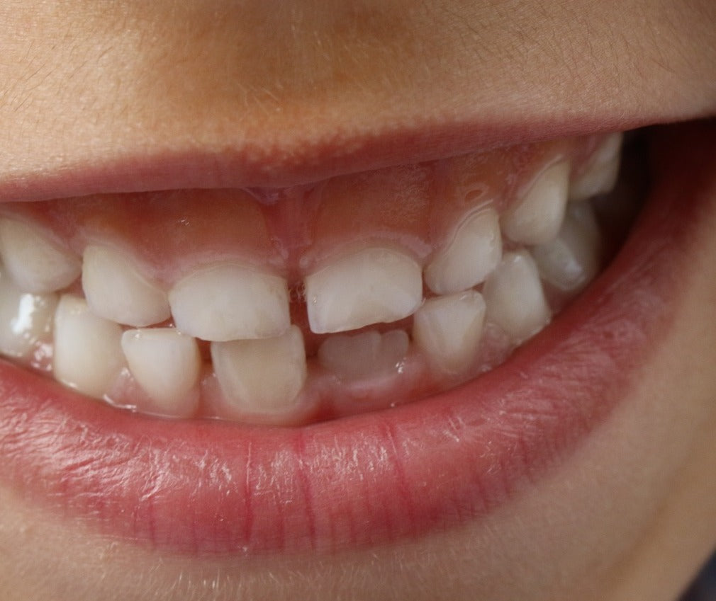 Cajitas de dientes, el mejor regalo para que el Ratoncito Pérez venga de visita